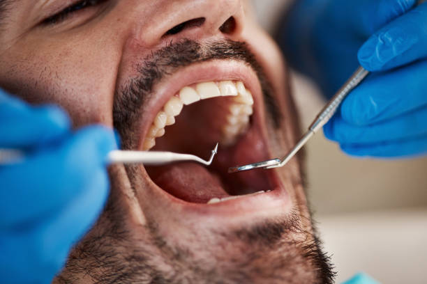 Best Emergency Treatment for Toothache in Stewartville, MN