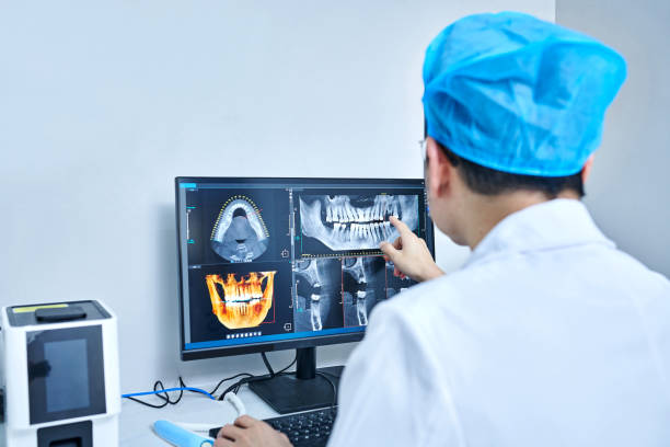 Best Emergency Tooth Extraction in Stewartville, MN